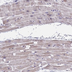 P2X3/P2RX3 Antibody, Novus Biologicals:Antibodies:Primary Antibodies